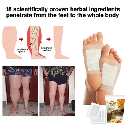 Original Bee Venom Foot Patch II Detox Patches 🌿👣(Set of 10+10) - Buy 10 Get 10 Free @ ₹599 ✅